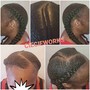 Scalp Treatment