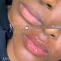 Hyaluron Lip Filler 1ml (1 session)