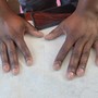 French on hands