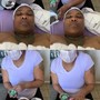 Head/Scalp Massage