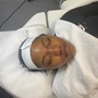 Microdermabrasion Facial