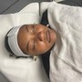 Microdermabrasion Facial