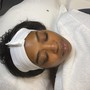 Microdermabrasion Facial