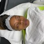 Microdermabrasion Facial