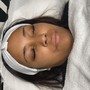 Microdermabrasion Facial