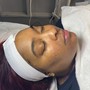 Microdermabrasion Facial