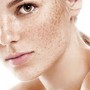 Chemical peel