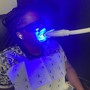 Teeth Whitening