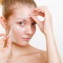 Chemical peel