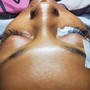 Eyelash Extension Removal