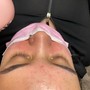 Eyelash Extension Removal