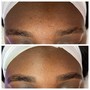 Brow Shaping