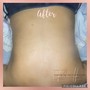 30 Minute Maternity Belly Facial