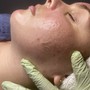 Birthday Special Facial