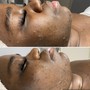 Deep Pore Cleanse Facial