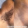 Underarm Wax