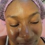 Hot Oil Treatment