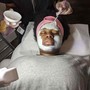 Chemical peel