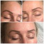 Eyebrow: Microblading