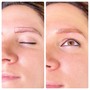 Eyebrow Correction