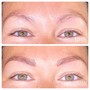 Eyebrow Correction