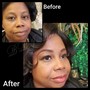 Lash Enhancement