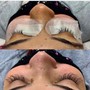 Eyelash Extension Removal