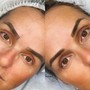 Lash Lift