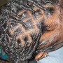 Scalp Treatment for hair growth