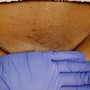 Underarm Wax