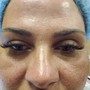 Eyelash Extension Removal