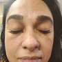 Eyelash Extension Removal