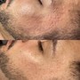 2 week fill (8-14 days)