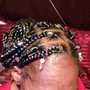 Scalp Treatment