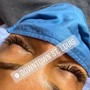 Eyelash Extension Removal