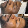 Klear Facial