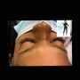 Eye lashes removal