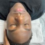 Enzyme Facial