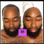 Bearded King Facial