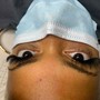 Eyelash Extension Removal