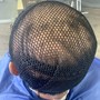 Decca Scalp Treatment