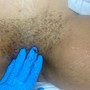 Chest Wax