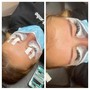 Full Face Wax