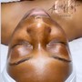 Acne Facial