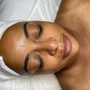 Chemical peel