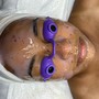 Oxygen Facial