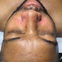 Back Facial