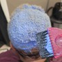 DANDRUFF SCALP TREATMENT