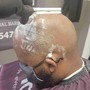 ELITE BALDNESS Scalp Treatment