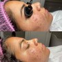 New Client Facial